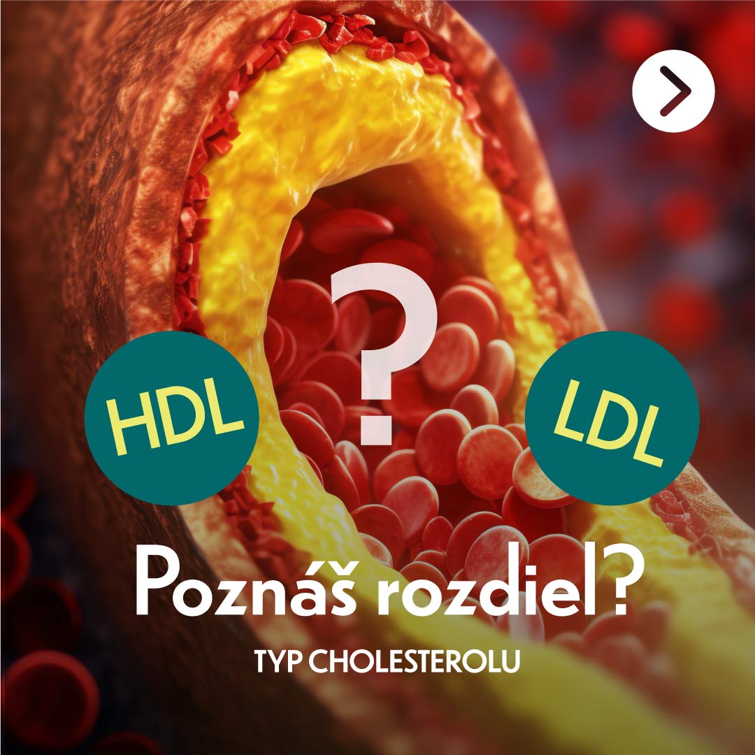 ake-su-správne-hodnoty-HDL-a-LDL