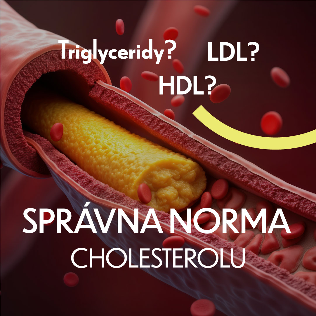 správna-norma-cholesterolu